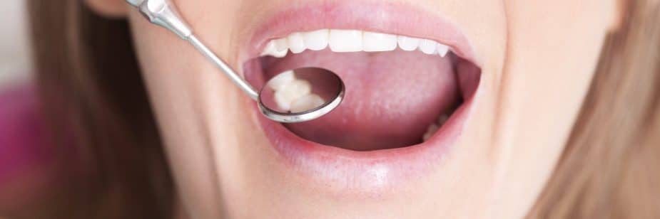 restauração do dente