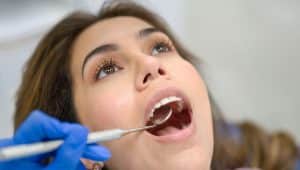 Periodontite avançada