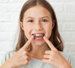 ortodontia preventiva