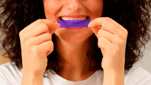 Fita clareadora dental funciona? Veja se a fita roxa clareia os dentes mesmo