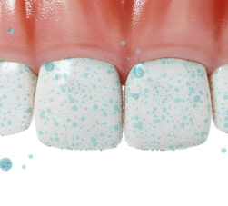 Remineralização do dente: o que é, como funciona e como proteger o esmalte