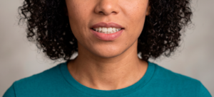 Sorriso invertido: o que é, causas e como corrigir