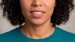 Sorriso invertido: o que é, causas e como corrigir