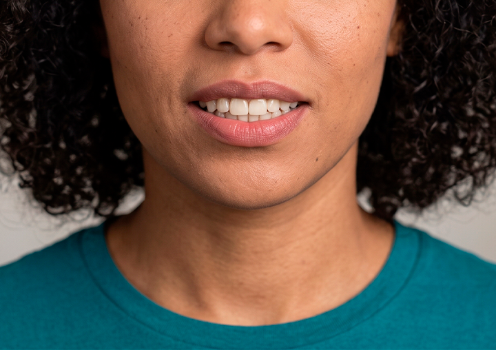 Sorriso invertido: o que é, causas e como corrigir